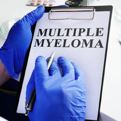 Multiple Myeloma – Symptoms, and Management Tips