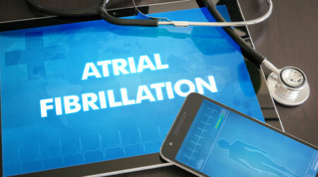 Atrial fibrillation – Causes, symptoms, and management tips
