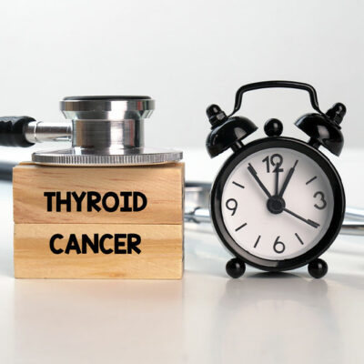 Thyroid cancer – Causes, Symptoms, and management